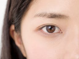 眼瞼下垂の原因と治療とは？切らずに行う手術や費用についても解説